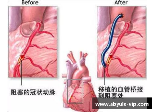 球员筋膜炎：症状、治疗与预防